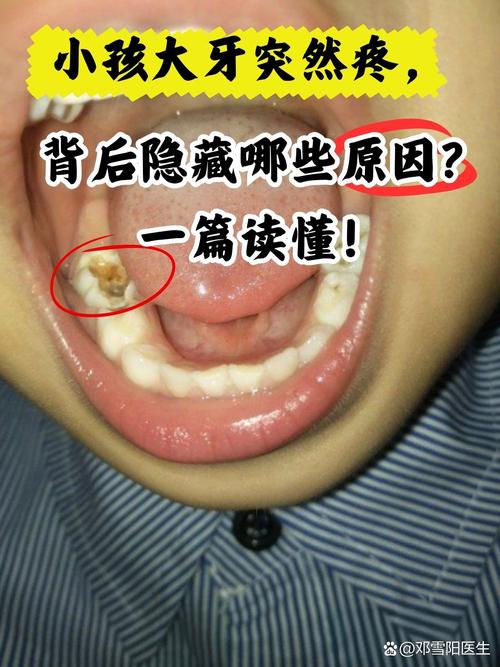 种牙后出现不良反应怎么办?-图2 种牙后出现不良反应怎么办?-图2