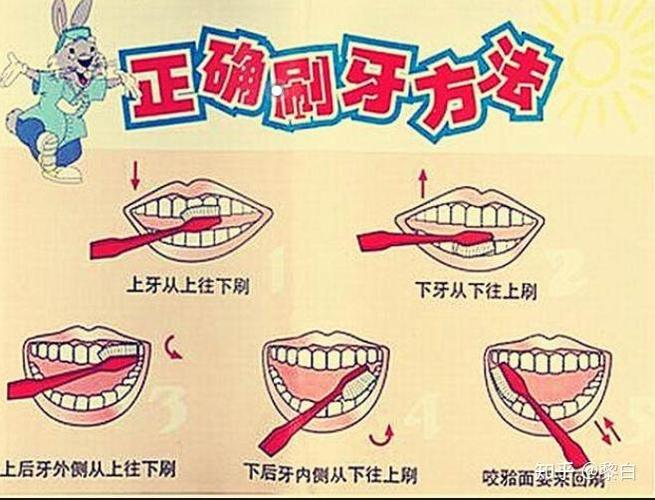 白牙齿的方法-图2