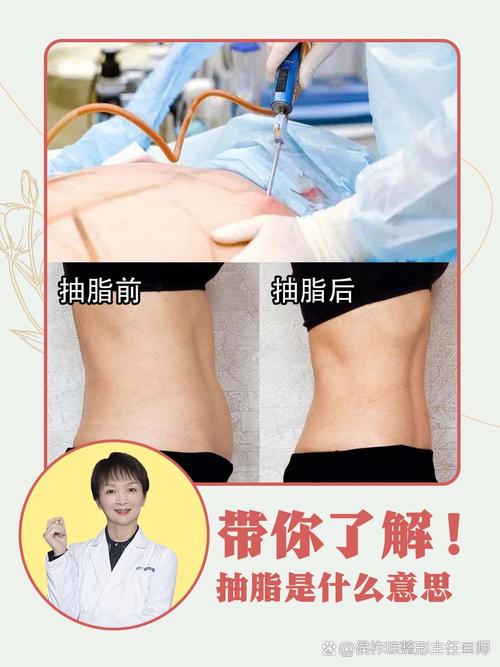 吸齿的方法-图1