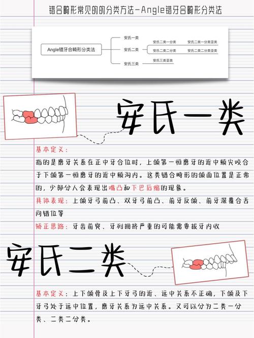 正畸安氏Ⅰ类矫正难度如何？-图1