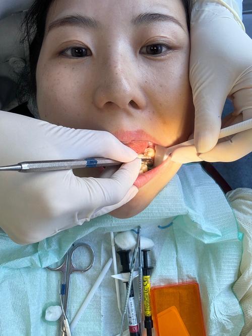 补牙有方法-图3