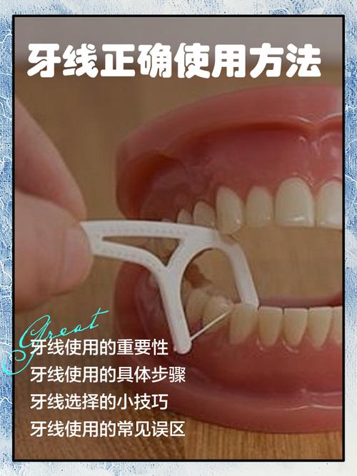 牙线使用方法有哪些？新手必学的正确步骤是怎样的？-图2