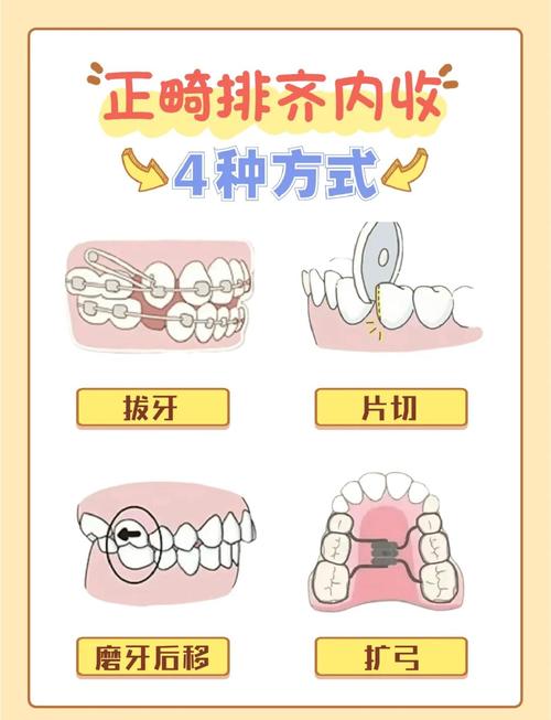 矫齿的方法-图2