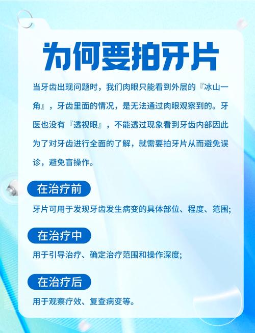 拍牙片方法-图1