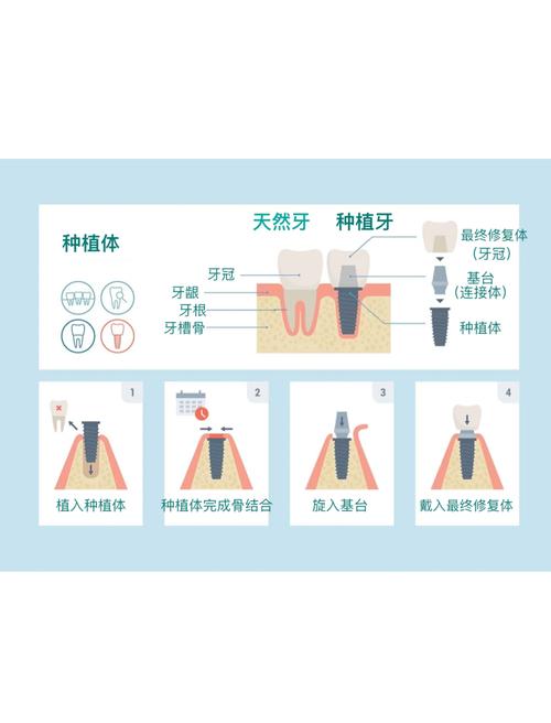 那种方法种牙好-图3