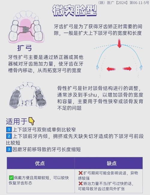 正畸的方法-图2 正畸的方法-图2