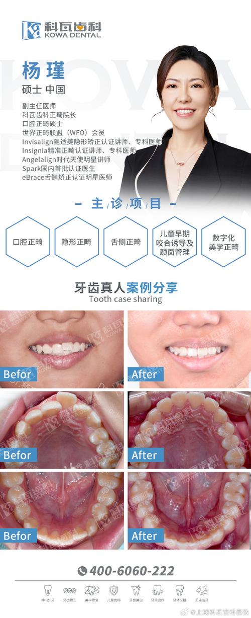 骨性2类正畸有用吗-图2