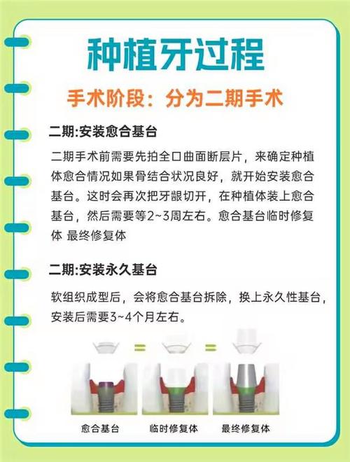 诺贝尔种牙流程-图2 诺贝尔种牙流程-图2