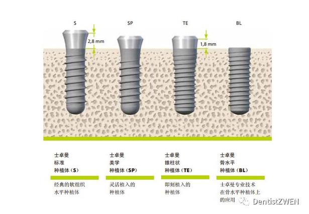 种牙植体iti-图3