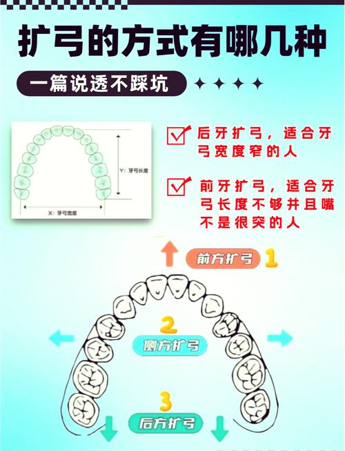 只扩弓不正畸可以吗-图1