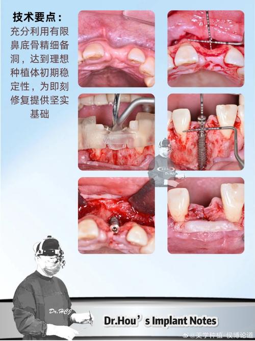 分享你们的种牙-图3