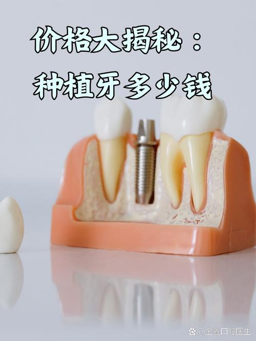 低价种牙可靠吗-图3 低价种牙可靠吗-图3