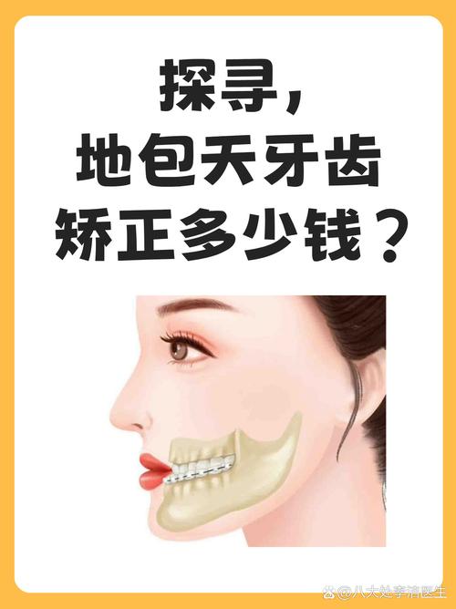地包天正畸的多少钱-图1