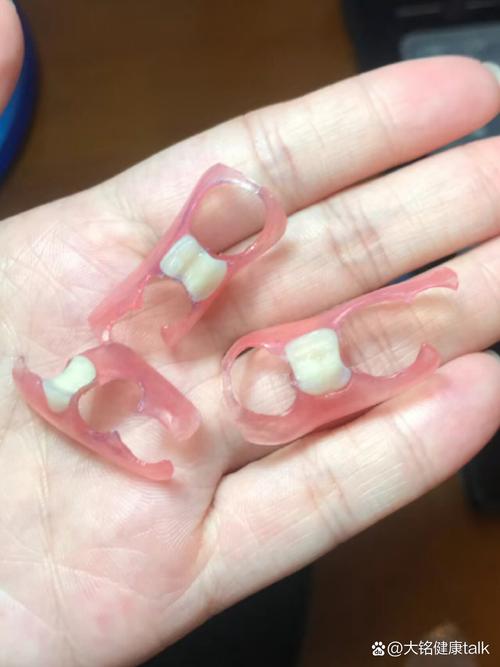 隐形牙有多少种-图1