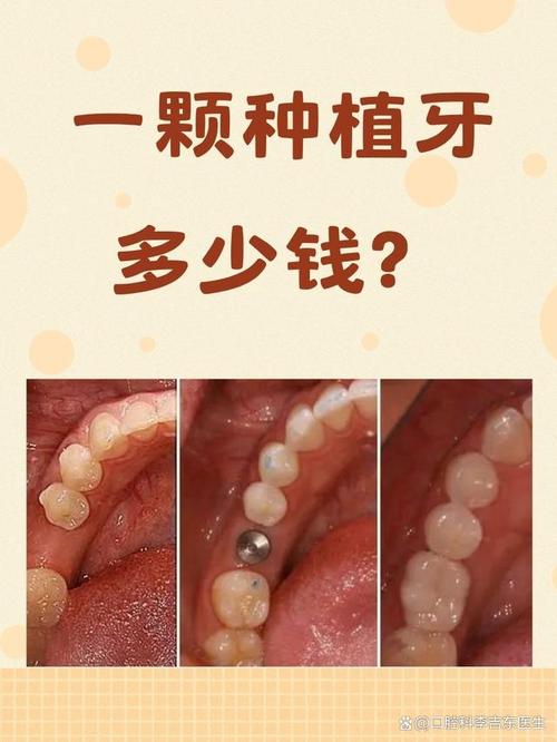 以色列种牙贵么-图1