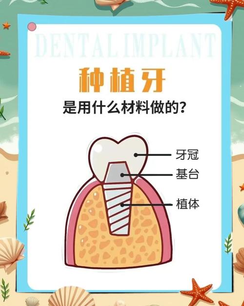 种牙材质有哪些-图2