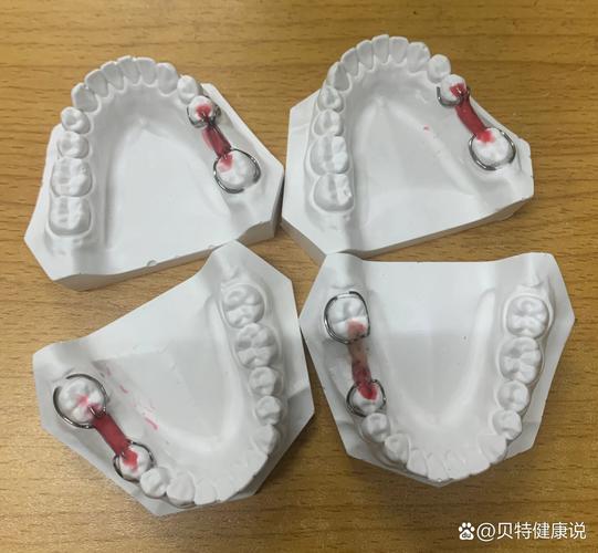 卡瓦数字化传统正畸-图3