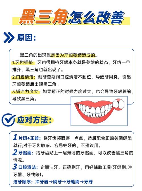 正畸如何关闭黑三角-图2