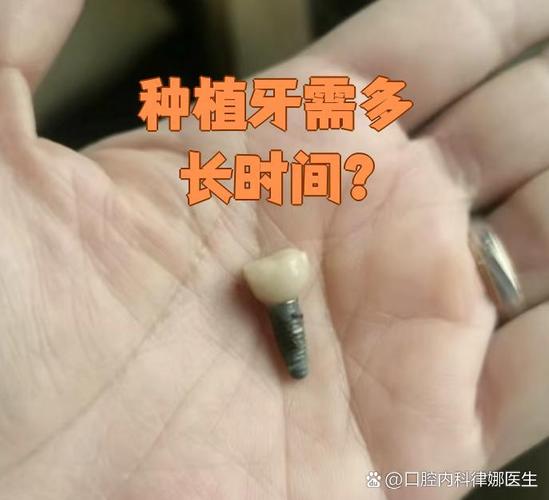 种植牙牙根松动是什么原因导致的？-图3