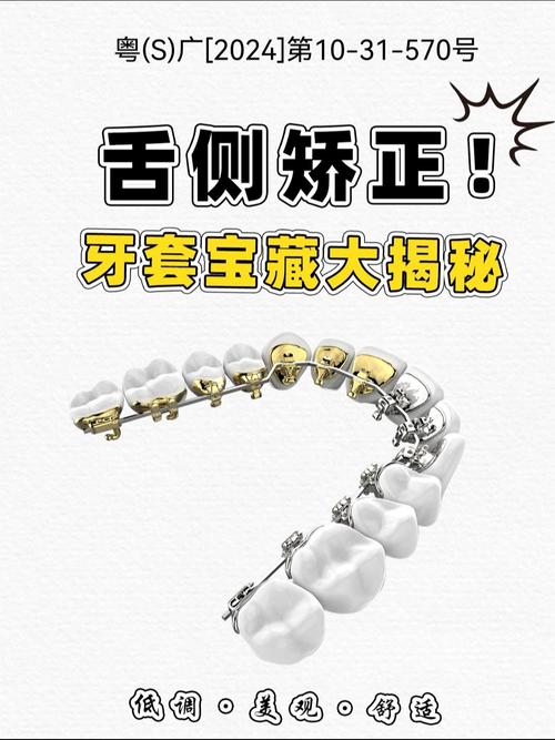 正畸舌挡是活动的吗-图3 正畸舌挡是活动的吗-图3