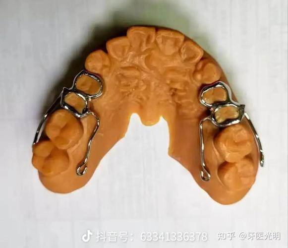 正畸随形弓图如何有效压低牙齿?-图1 正畸随形弓图如何有效压低牙齿?-图1