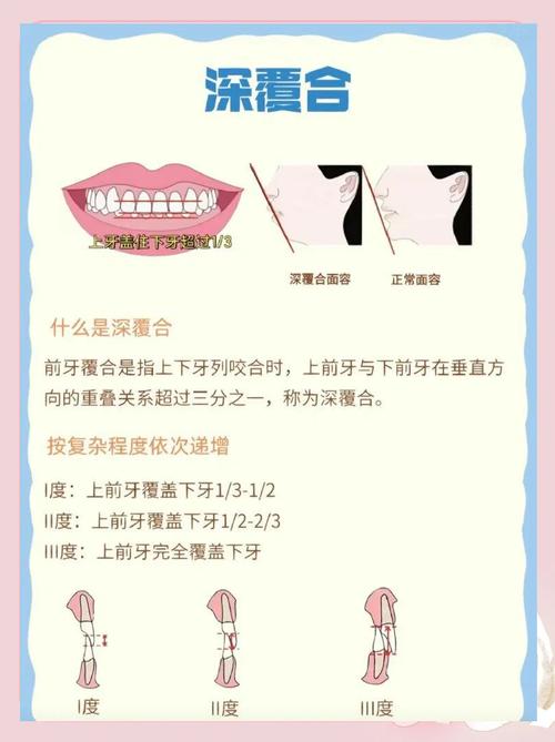 深覆盖适合做正畸吗-图3