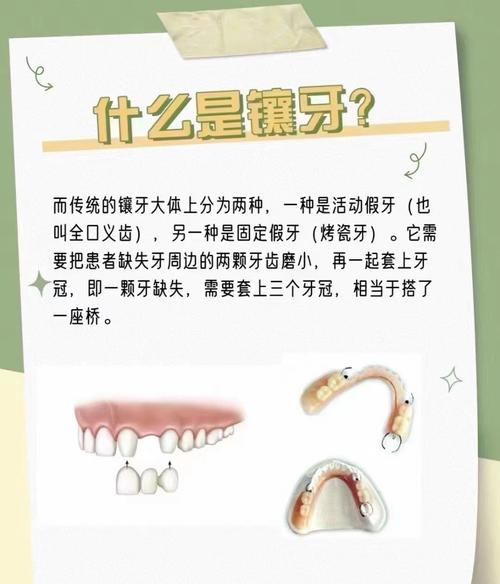 种牙真的没缺点-图1