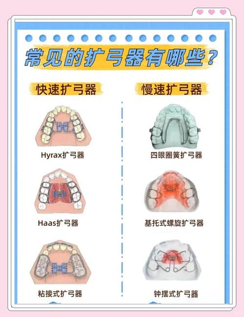 正畸必须戴矫治器吗？矫正方式有其他选择吗？-图1