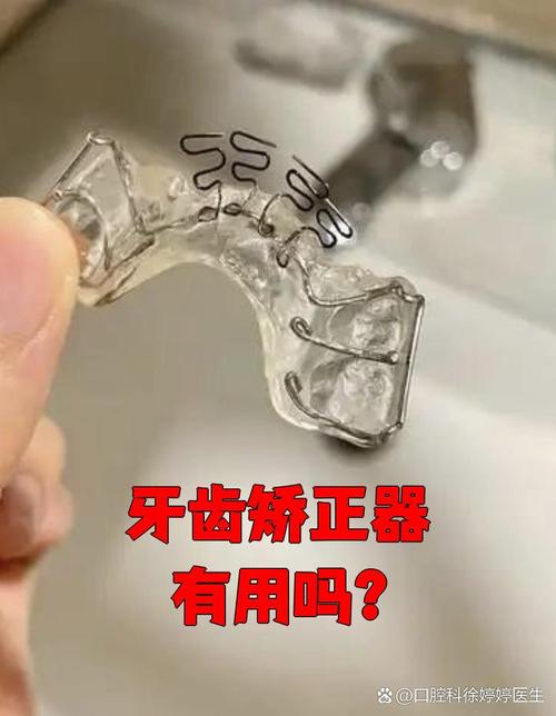 正畸必须戴矫治器吗？矫正方式有其他选择吗？-图3