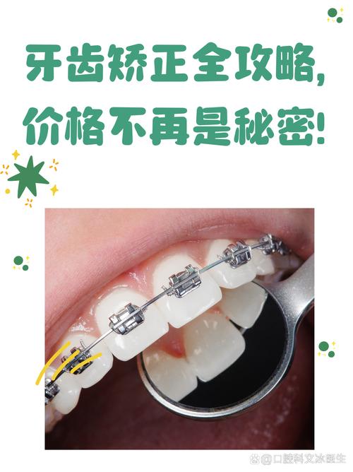 隐形正畸一般要花多少钱？费用差异影响因素有哪些？-图2