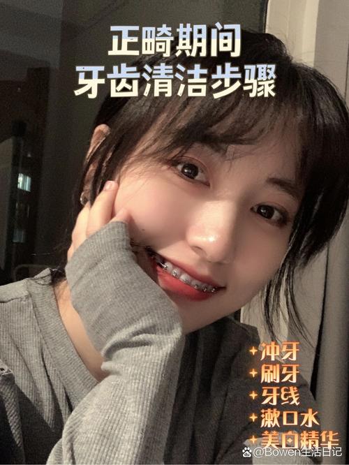 正畸牙齿前要洗牙吗-图3