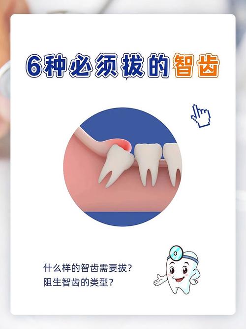 智慧牙可以种吗-图2