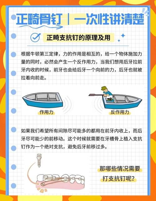 正畸牙为什么打骨钉-图2