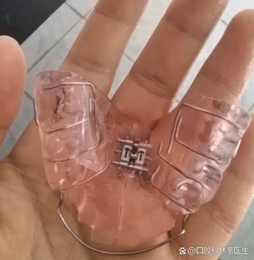 正畸树脂颌垫怎么做？制作流程、材料选择及操作要点-图1