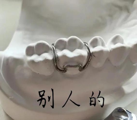 正畸邻间钩弯制方法有哪些关键操作技巧？-图1