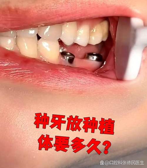 金华种牙哪里好？医院怎么选？求推荐靠谱的机构？-图3