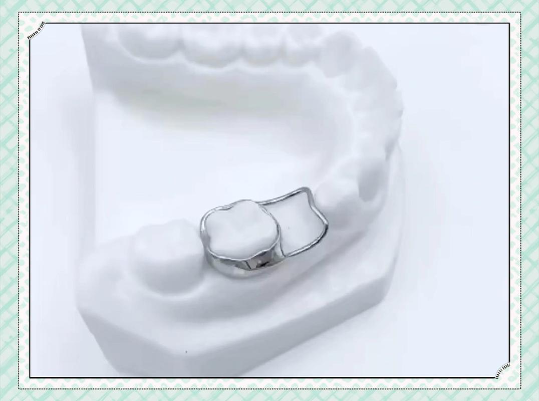 如何通过图片弯制正畸保持器？-图1