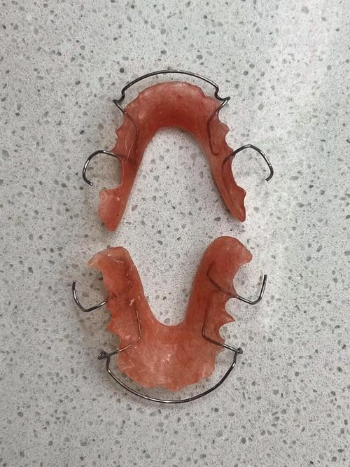 如何通过图片弯制正畸保持器？-图2