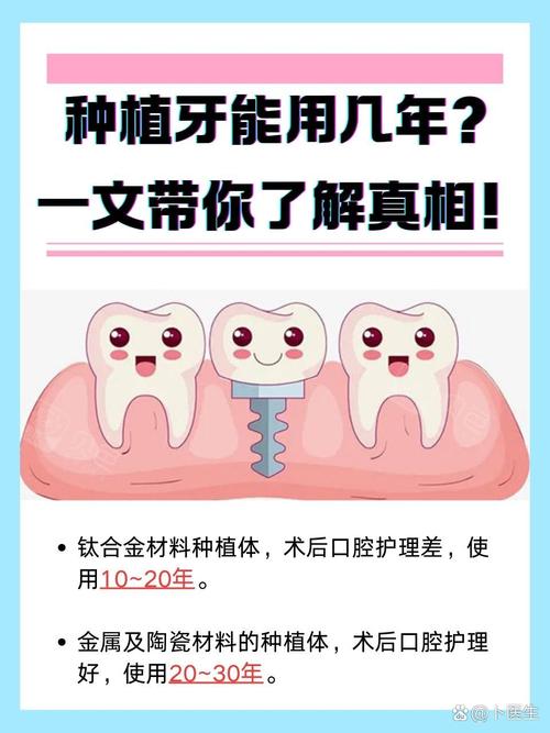 种牙后能用几年？影响使用寿命的因素有哪些？-图2
