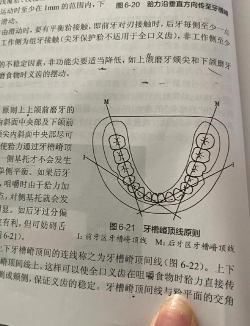 单独种牙的费用大概是多少点？-图3