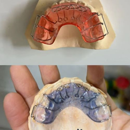 正畸推簧弯制方法如何掌握？关键步骤与技巧-图2