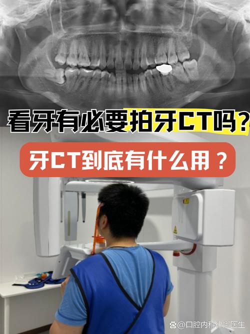 种牙前，锥形束CT检查为何必不可少？-图1