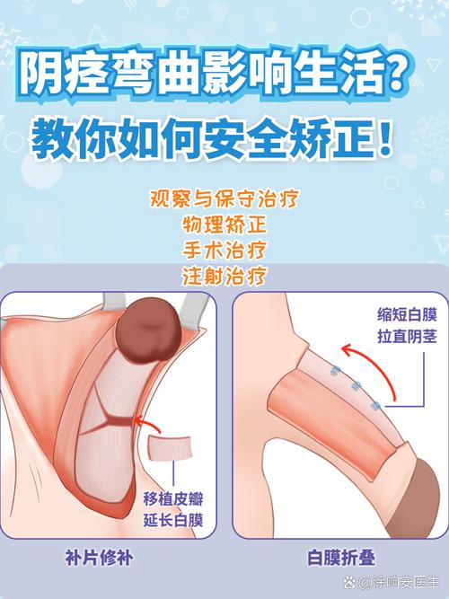 正畸控根簧弯制方法-图1 正畸控根簧弯制方法-图1