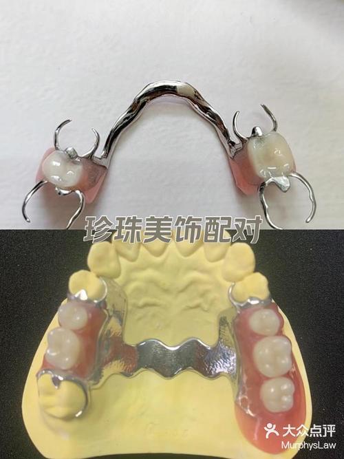 种牙前为何要戴义牙？作用与必要性是什么？-图3