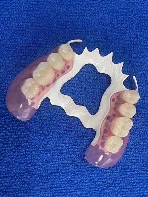 种牙前为何要戴义牙？作用与必要性是什么？-图1