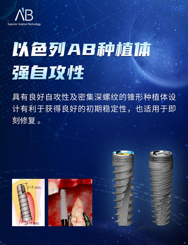 以色列种牙技术-图1