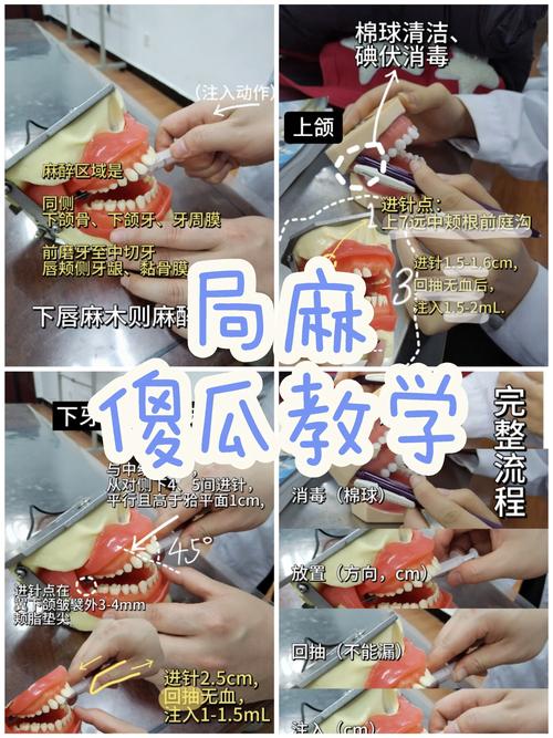 种牙麻醉 味觉-图2