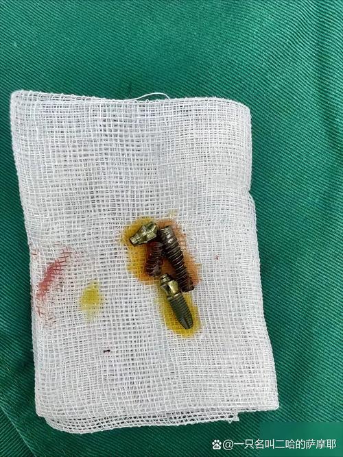 牙齿掉了 种牙-图1