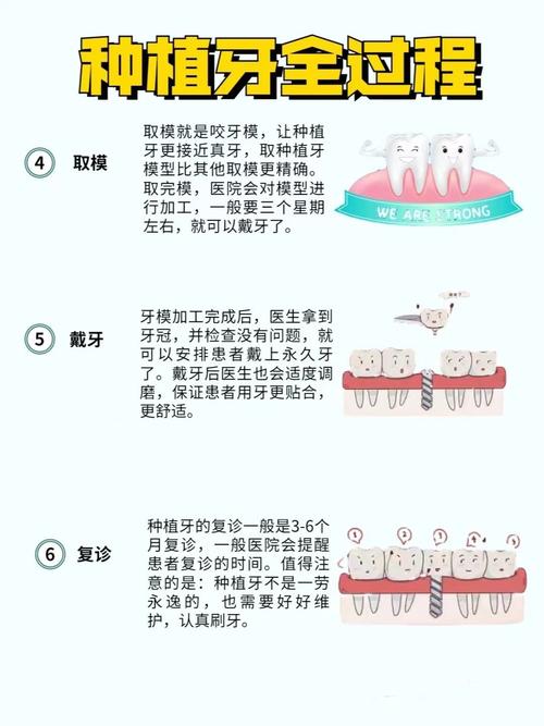 种牙流程耗时多久？各阶段时间安排如何？-图2