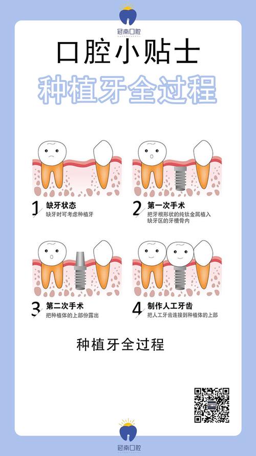 种牙流程耗时多久？各阶段时间安排如何？-图1